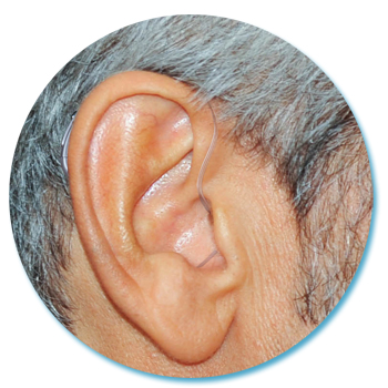 Miniature Behind-The-Ear Hearing Aid for senior citizen